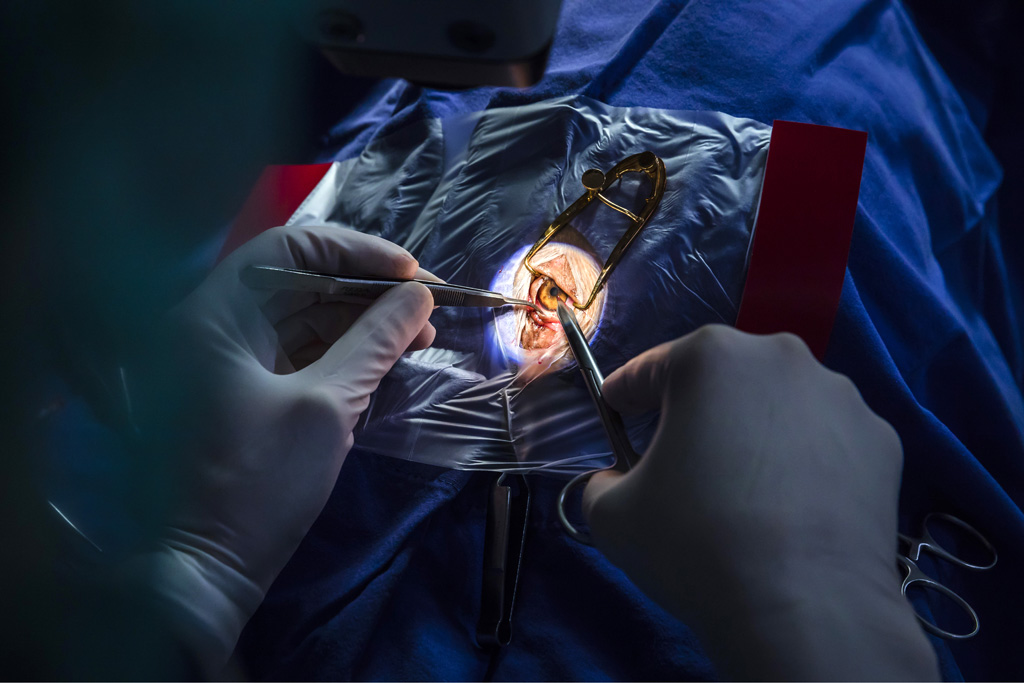 Hamburg / 10.12.2018 - Augenoperation Tierklinik ãAnicuraÒ. Augen OP mit Spezial-Mikroskop . Fotoreportage: Augenoperation in der Tierklinik ãAnicuraÒ - 10.12.2018 - Hamburg.
AniCura ist ein europischer Anbieter fr die tierrztliche Versorgung von Haustieren uns spezialisiert auf High-Tech Medizin. OP-Hund: Eddie (8) Rasse: Magyar Vizsla (ungarischer Jagthund).
Besitzerin: Sandra Khl (mit Fotos einverstanden).
Operateur: Tierrztin Dr. Teresa Bilotta .